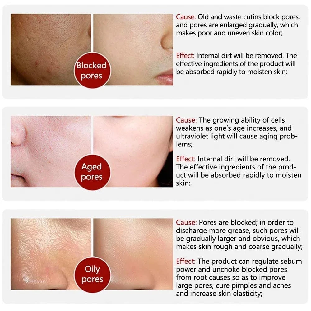 Retinol & Niacinamide Pore Refining Facial Serum