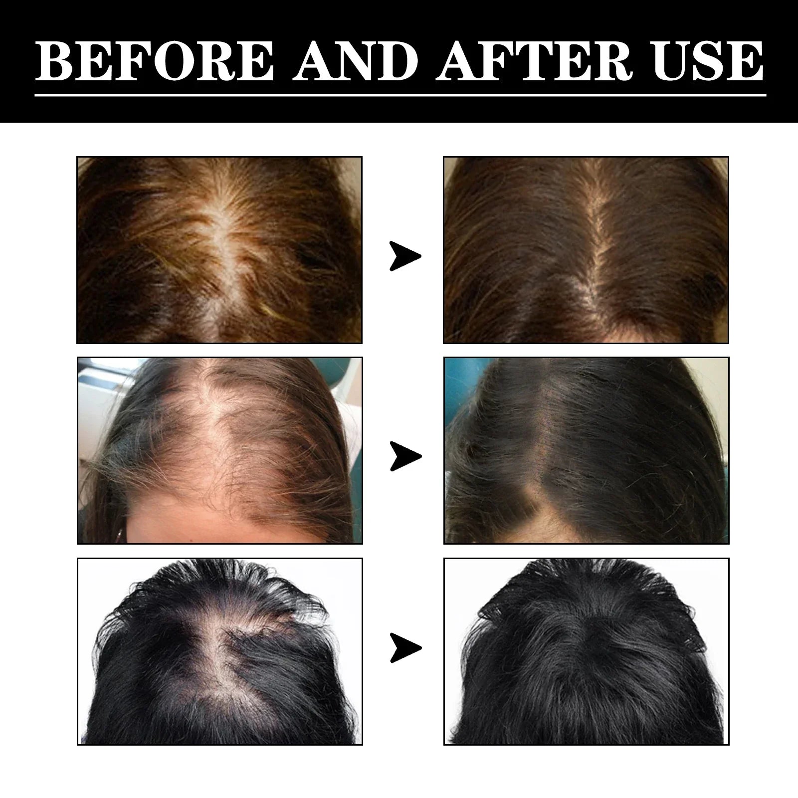 Deep Penetrating Hair Care Essence