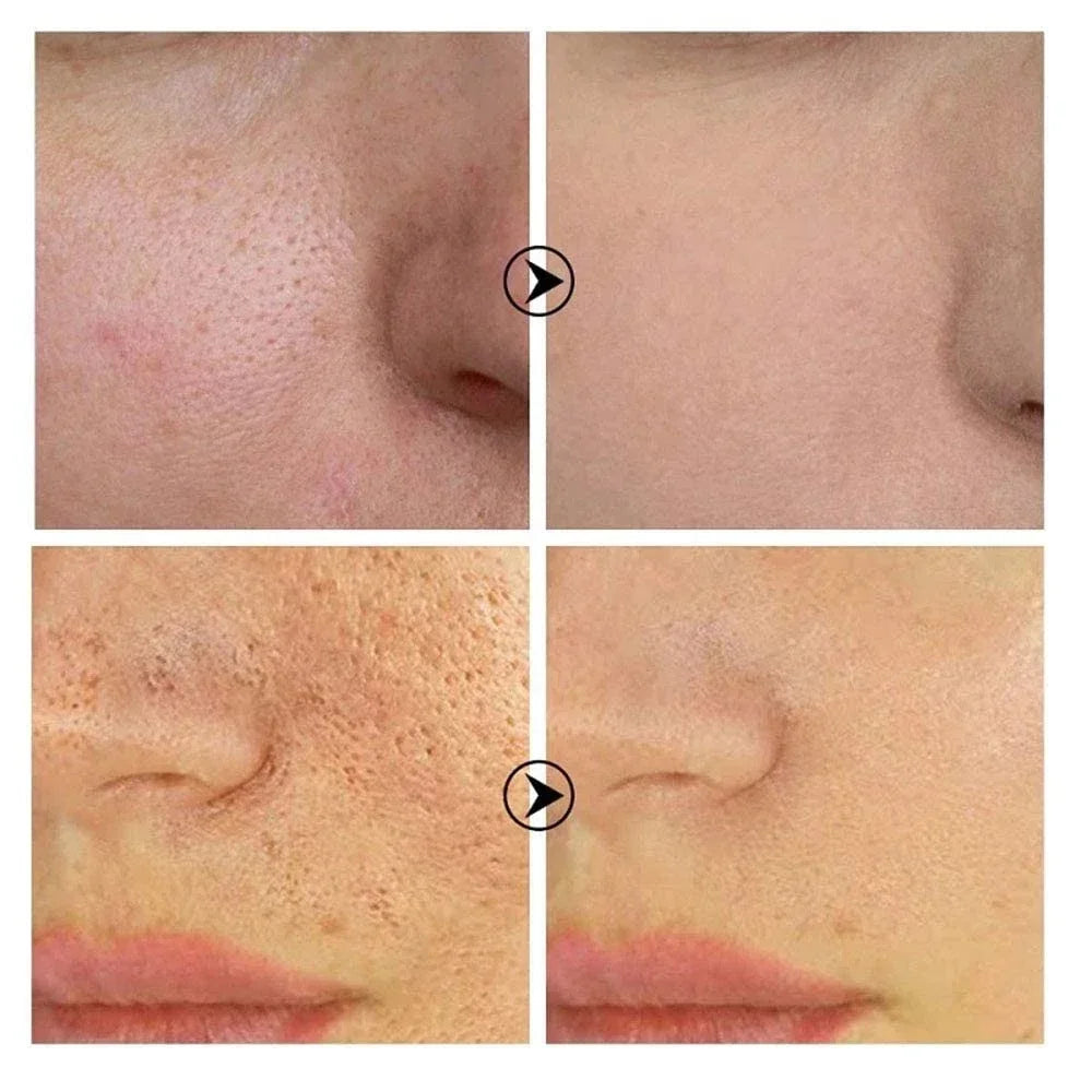 Retinol & Niacinamide Pore Refining Facial Serum
