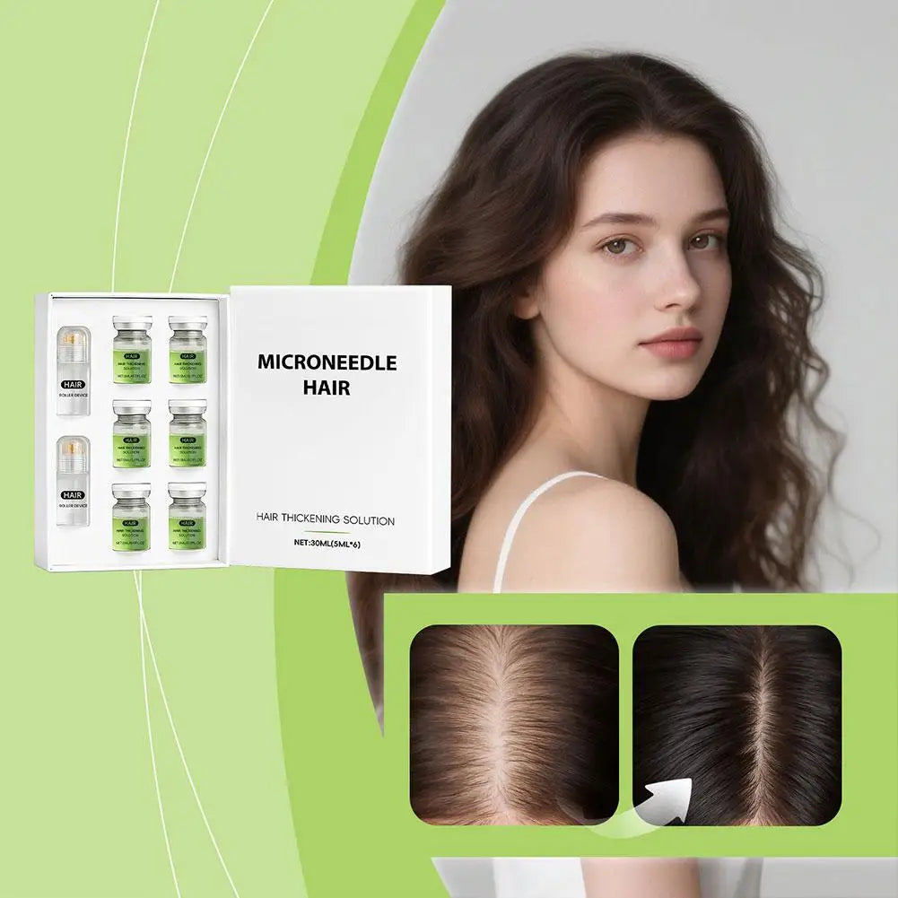 Hair Roller Scalp Serum – Anti Hair Loss