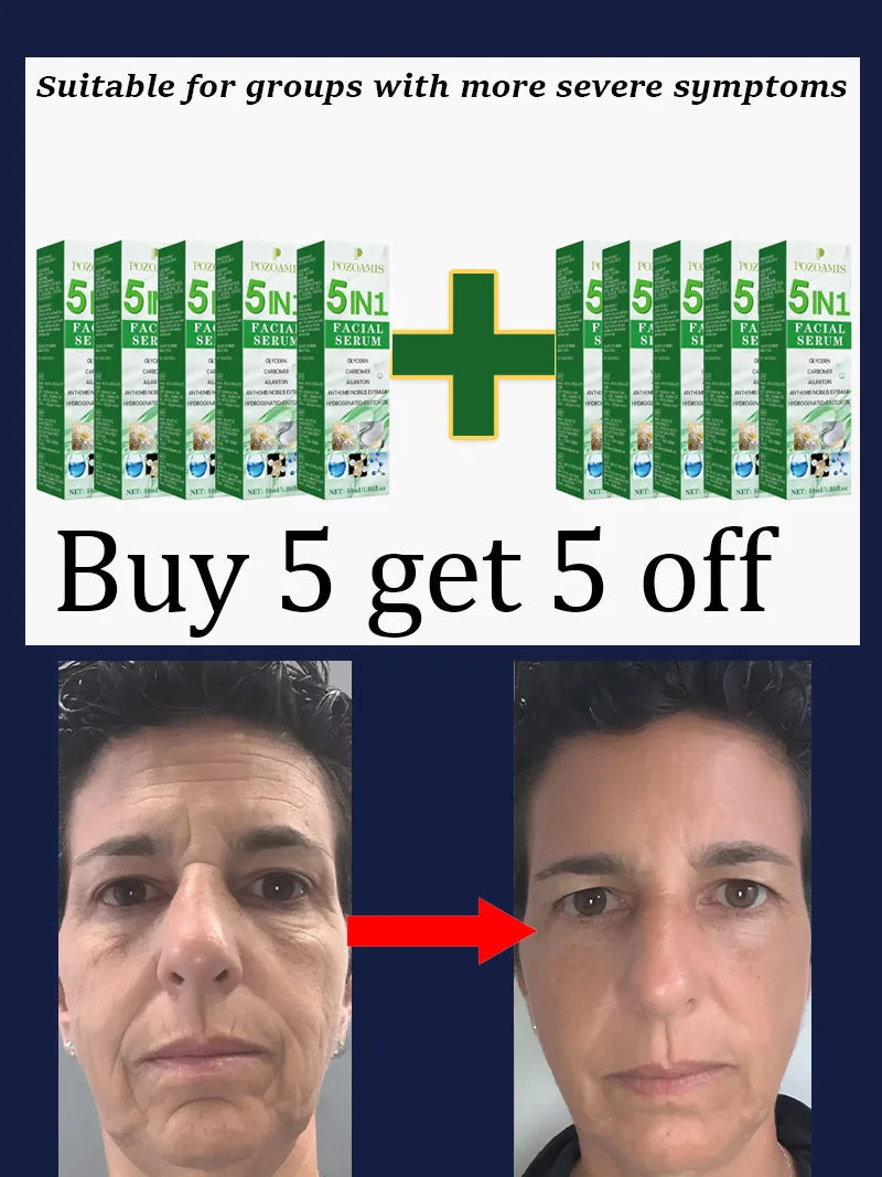 Home Skincare Wrinkle Removal Tools