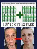 Home Skincare Wrinkle Removal Tools