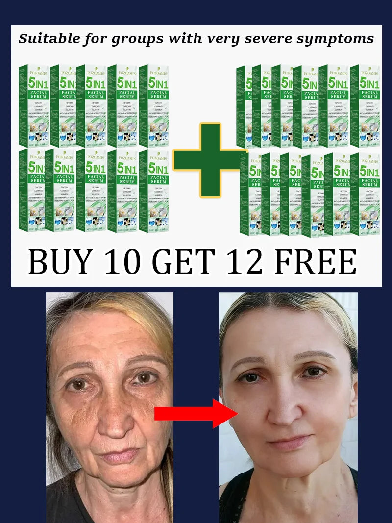 Home Skincare Wrinkle Removal Tools