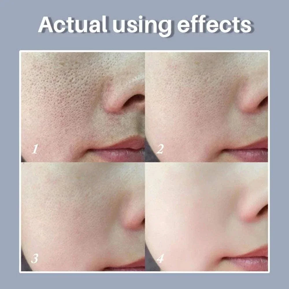 Retinol & Niacinamide Pore Refining Facial Serum